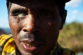 Visually impaired man, Ambositra, Madagascar, Africa