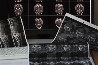 A collection of various MRI images and X-ray images of the brain, including images of a screen and