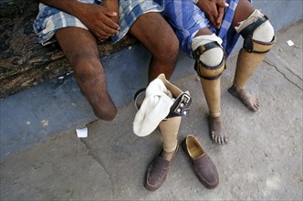 Two double leg amputees with leg prostheses, Jaipur, India. These prostheses are called Jaipur foot