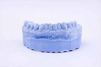 Denture impression of an upper jaw for dentures, dentist, dental impression