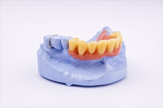 Removable denture of an upper jaw, denture, denture, dentist, dental impression