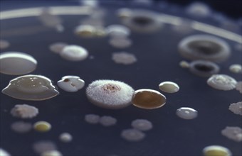 Bacteria and moulds growing on agar in a petri dish