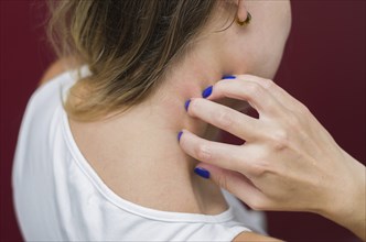 Great concept of allergy and skin diseases, young woman scratching herself