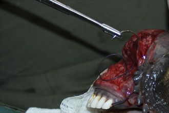 A vet sews up the torn bottom lip of a red deer hind in New Zealand