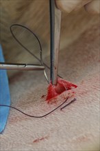 A vet sews up the incision in the abdomen of a surrogate hind during an embryo transfer programme