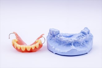 Removable denture of an upper jaw, denture, denture, dentist, dental impression