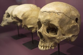 Soldier's battle scarred skull showing musket ball entry hole in the Memorial 1815 museum and