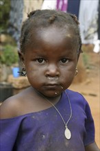 Close up portrait of little black child with running nose in Zambia, Southern Africa