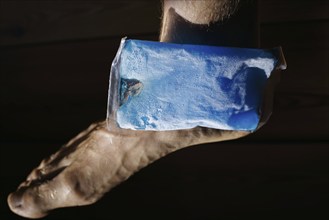 Symbolic photo on the subject of cooling for joint pain. A cooling pad is placed on an ankle and