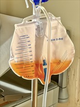 Man in hospital, after urological surgery, with urine bag on a urinary catheter