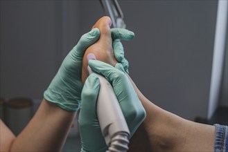 Podiatric foot treatment, milling of the epidermis with a tool. A close-up of the treatment. Close