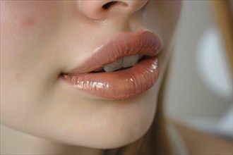 Close up of large plump lips of woman with Hyaluronic acid beauty fillers, KI generiert, generiert,