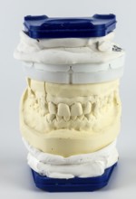 Vertical dental model in blue and white, shows upper and lower jaw made of plaster in detail