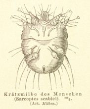 Historical wood engraving, illustration from Meyers encyclopedia 4th edition 1889 and 1890, scabies