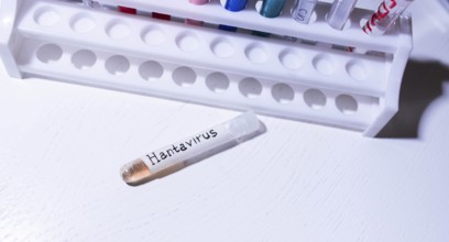 Test tube labeled Hantavirus placed near a rack in a lab setting