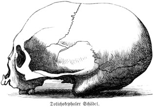 Dolichocephalic skull, long head with flat forehead and pronounced occiput, side view, skullcap,