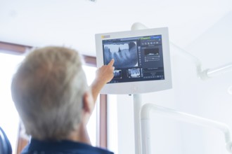 A person points to a screen with an X-ray image in a medical environment, dental practice, Germany,