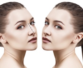 Female face before and after cosmetic nose surgery over white background