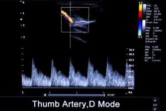 Colourful image of modern ultrasound monitor. Ultrasonography machine. High technology medical and