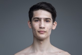 Studio portrait of a young brunette caucasian man on grey background posing. Puberty theme, problem