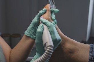 Podiatric foot treatment, milling of the epidermis with a tool. A close-up of the treatment. Close