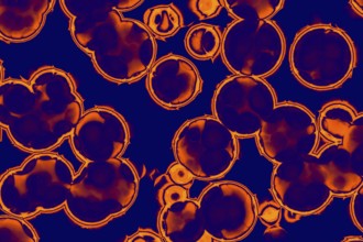 Shape of bacterial cell: cocci, bacilli, spirilla bacteria background