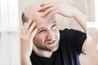 Male alopecia or hair loss concept, adult caucasian bald man looking mirror for head baldness