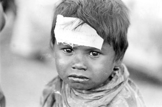 Sick child, union carbide gas leak tragedy, Bhopal, madhya pradesh, India, Asia