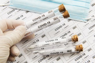Many covid-19 test tubes for lots of testing