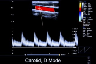 Colourful image of modern ultrasound monitor. Ultrasonography machine. High technology medical and