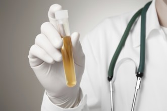 Doctor holding a bottle of urine sample