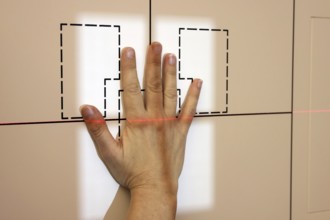 X-ray of one hand