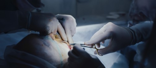 Hands performing a surgical procedure with precision, the focus on incision work