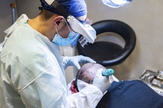 Doctor performing hair transplant. Surgeons in the operating room carry out hair transplant surgery