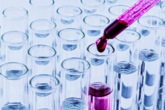 Many test tubes during an experiment in a university research laboratory. Symbolic photo for