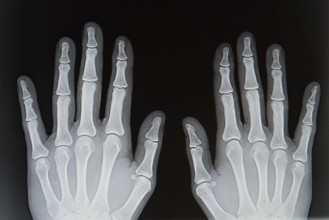 X-ray from human hands