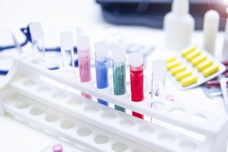 Colorful test tubes and medicine on a bright laboratory table