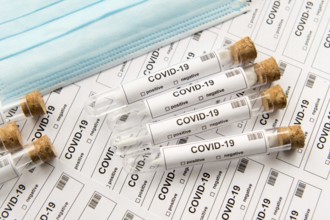 Many covid-19 test tubes for lots of testing