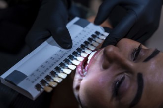 Dentist comparing patient's teeth shade with tooth whitening shade guide palette in dental clinic