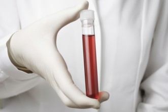 Doctor holding a bottle of blood sample