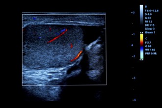 Colourful image of modern ultrasound monitor. Ultrasonography machine. High technology medical and