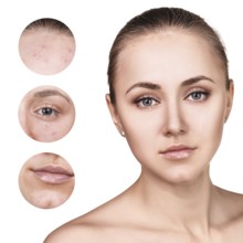 Portrait of young woman and circles shows problem skin over white background