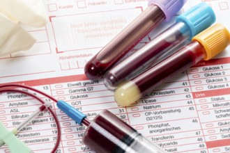 Blood samples are taken on a laboratory form to determine the blood values