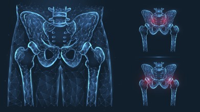 Bones of the pelvis and hip, human anatomy. Pelvic and hip injuries. X ray of the hip joint made of