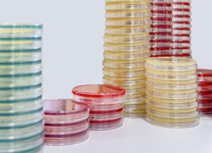 Lots of stacked petri dishes filled with colorful agar growth medium