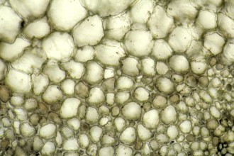 Full frame micrography showing the cell structure of a Bryophyllum plant