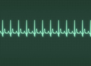 A electrocardiography illustration in dark screen background