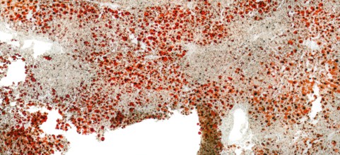 Full frame abstract microscopic detail of a human fatty liver