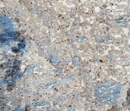 Stained full frame human placenta micrography