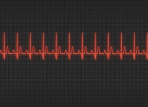 A electrocardiography illustration in dark screen background